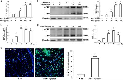 Targeting Tristetraprolin Expression or Functional Activity Regulates Inflammatory Response Induced by MSU Crystals